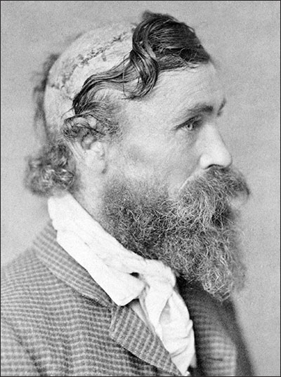 PHOTO: Robert McGee with scalping scars