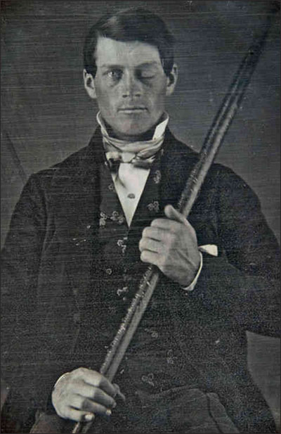 PHOTO: Phineas Gage